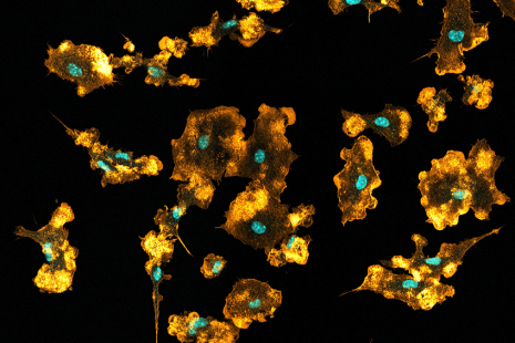 Source : Macrophages recycle phagocytosed bacteria to fuel immunometabolic responses, Nature, https://doi.org/10.1038/s41586-025-08629-4